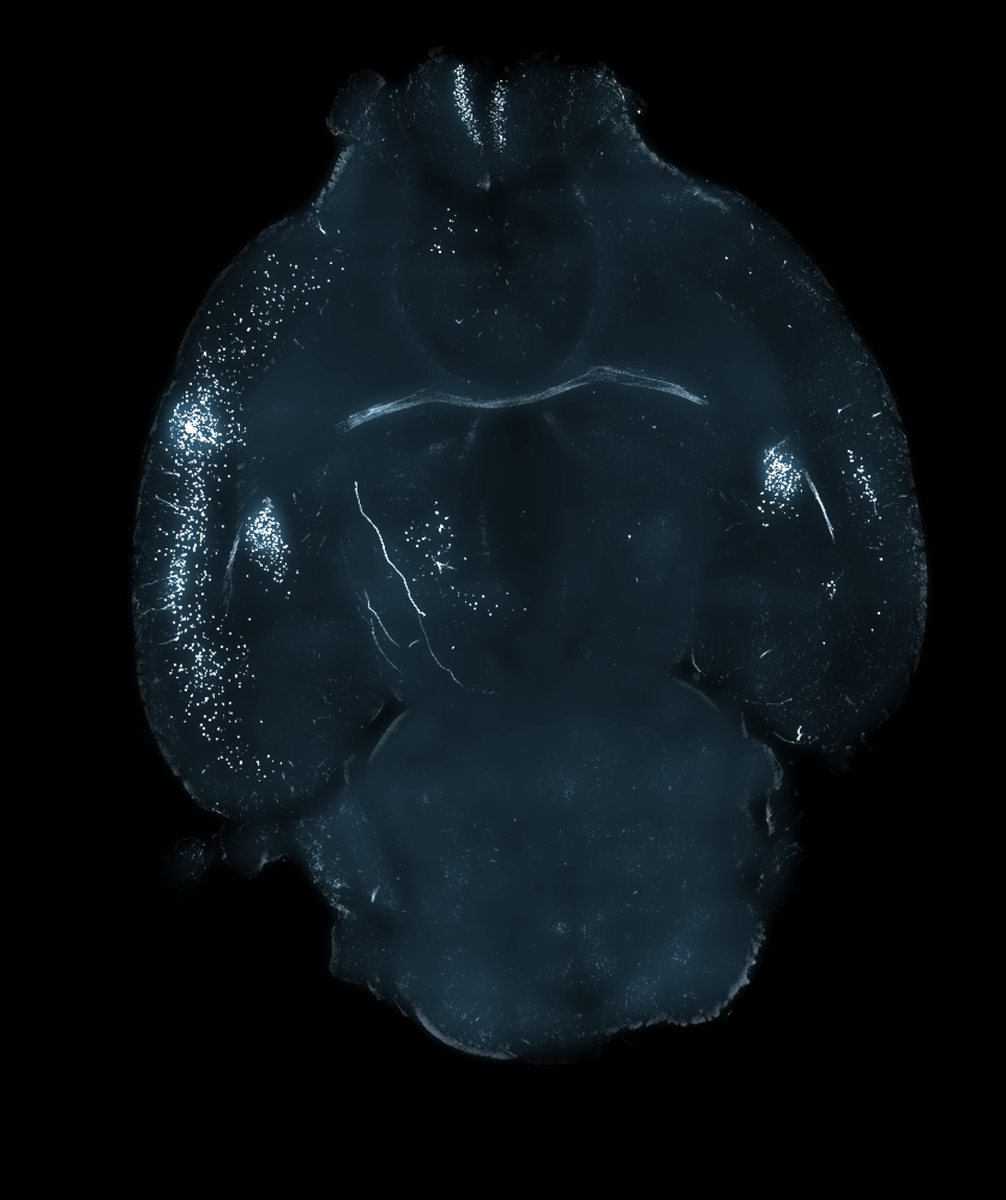 Whole-brain light sheet image of insula-projecting stress-activated neurons