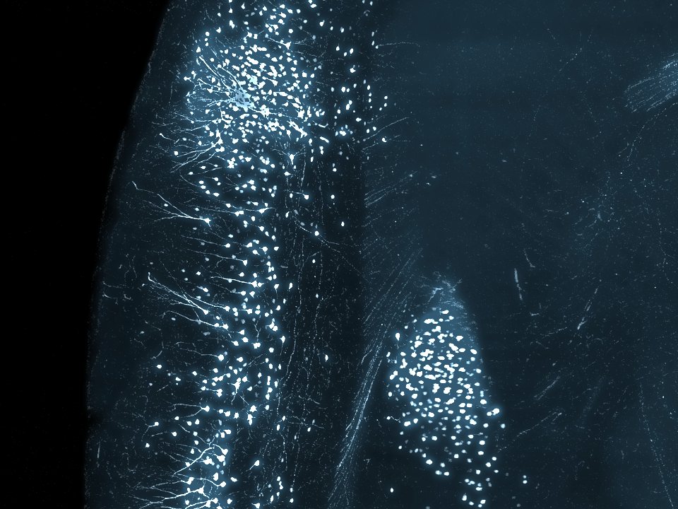 Stress-activated neurons in the insular cortex imaged with light sheet microscopy