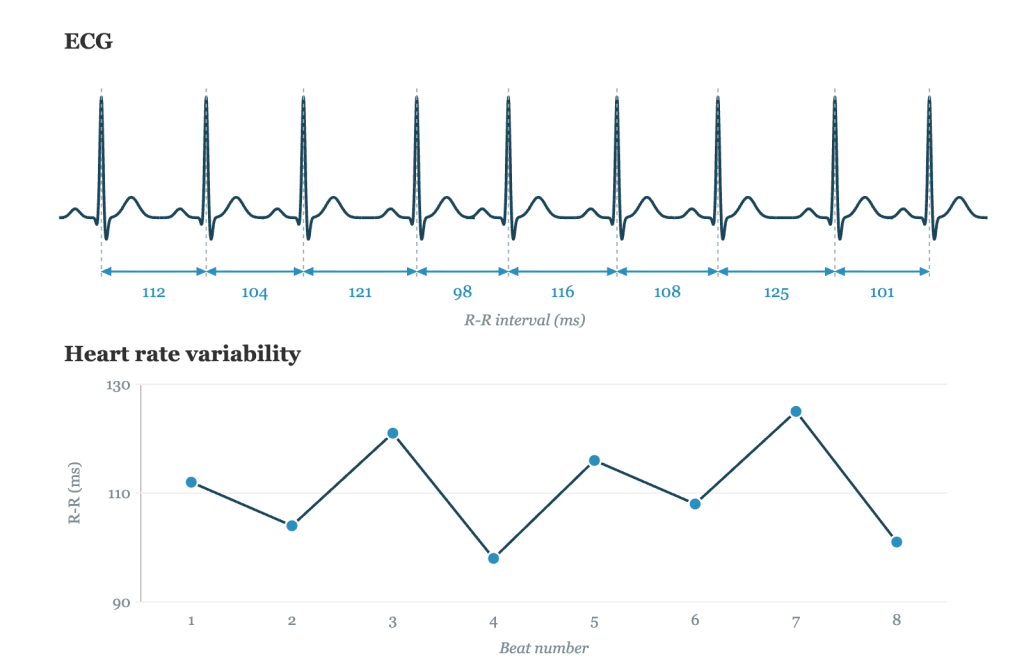 Illustration of an ECG trace with beat to beat R-R intervals and the resulting heart rate variability